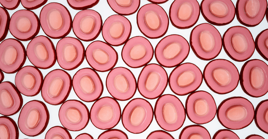 Toczeń rumieniowaty układowy SLE: Diagnostyka, Objawy i Leczenie